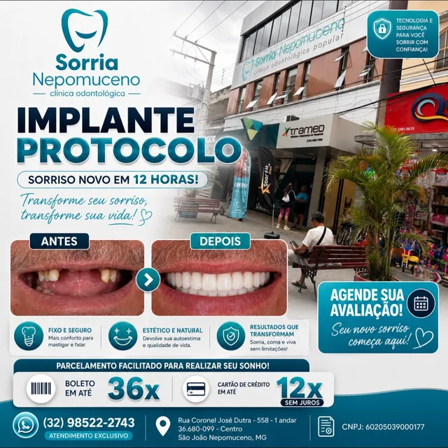 Arte sobre implante protocolo com condições especiais